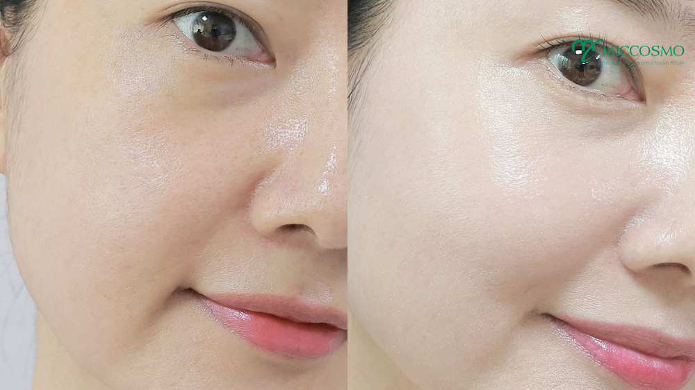 niacinamide-trong-my-pham2.png