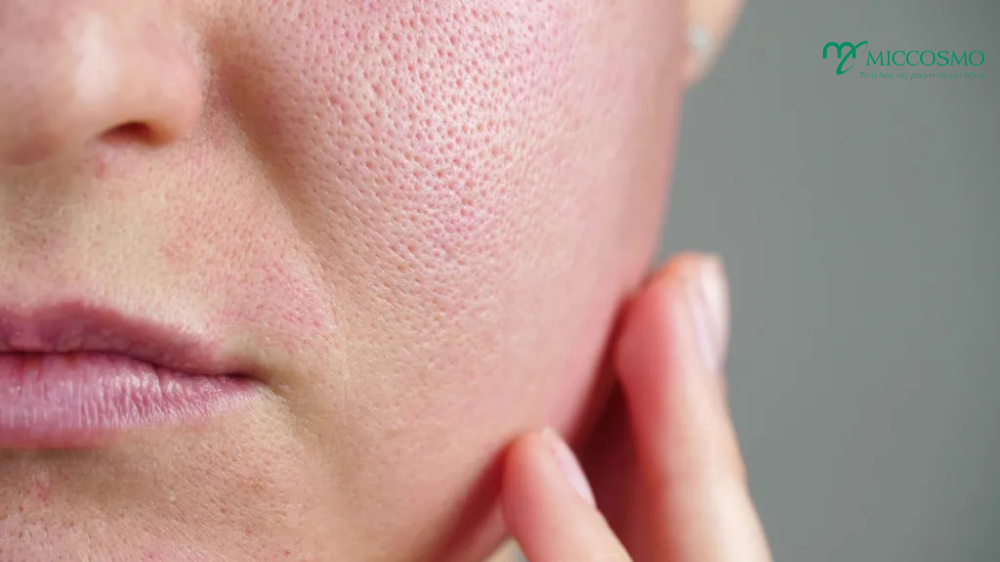 niacinamide-trong-my-pham4.png