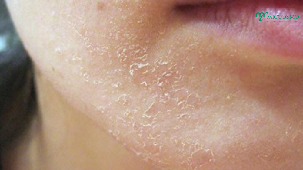 skincare_cho_da_kho-1.png