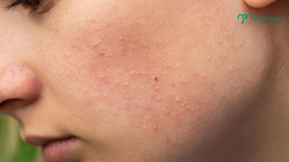 trinh-tu-skincare-buoi-sang-2.png