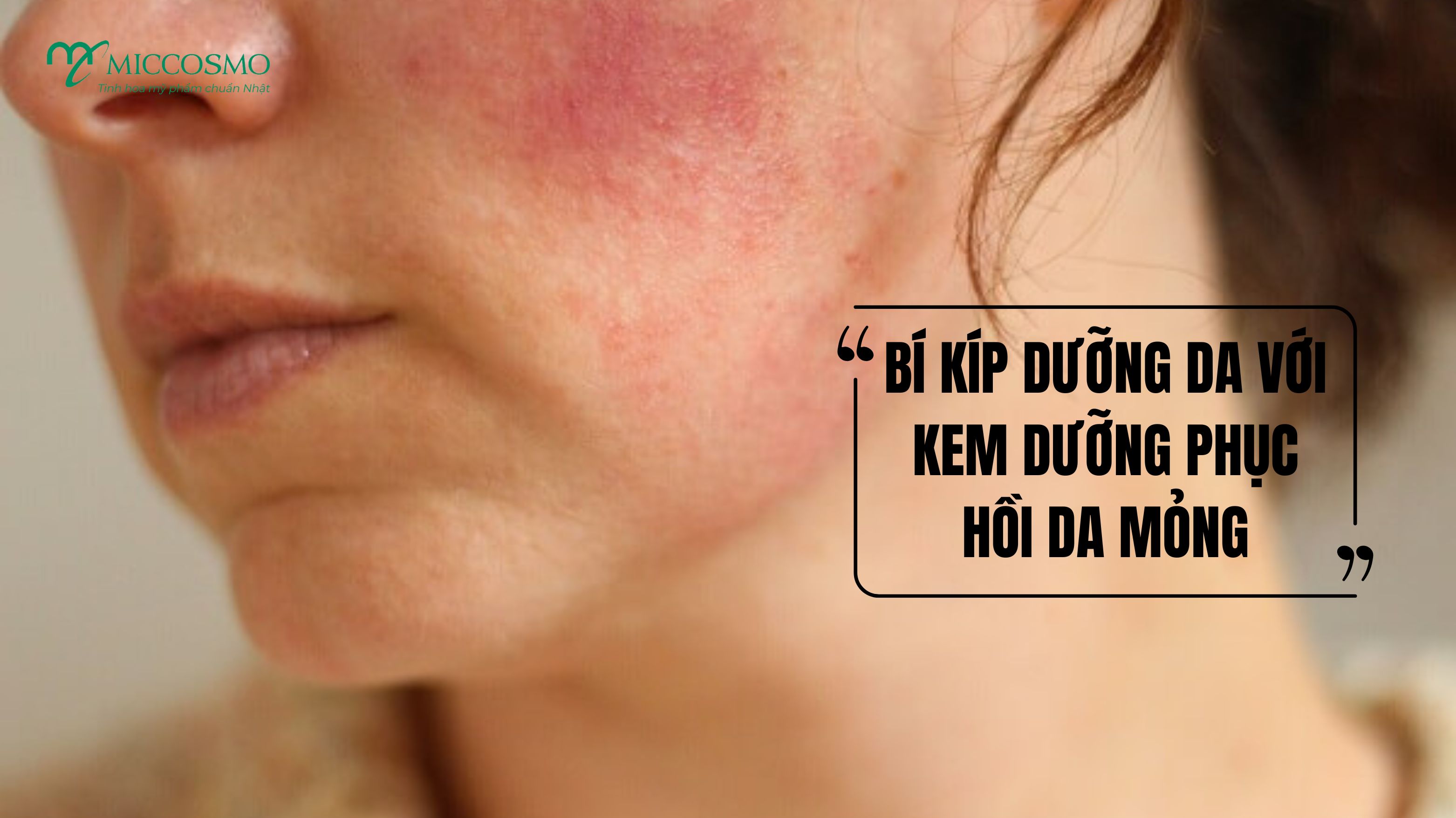 Bí Kíp Dưỡng Da Khỏe Với Kem Dưỡng Phục Hồi Da Mỏng