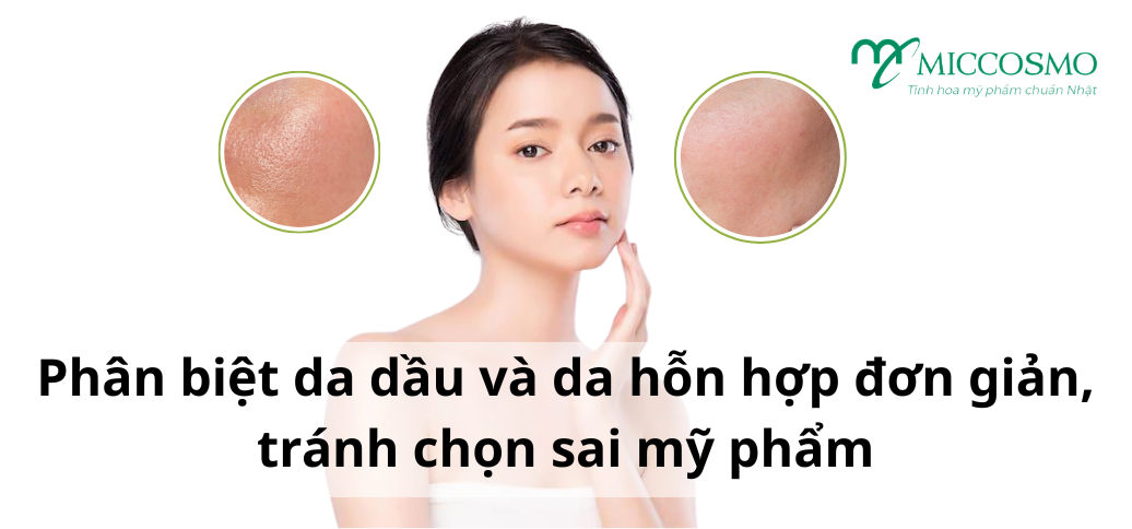 Phân biệt da dầu và da hỗn hợp đơn giản, tránh chọn sai mỹ phẩm