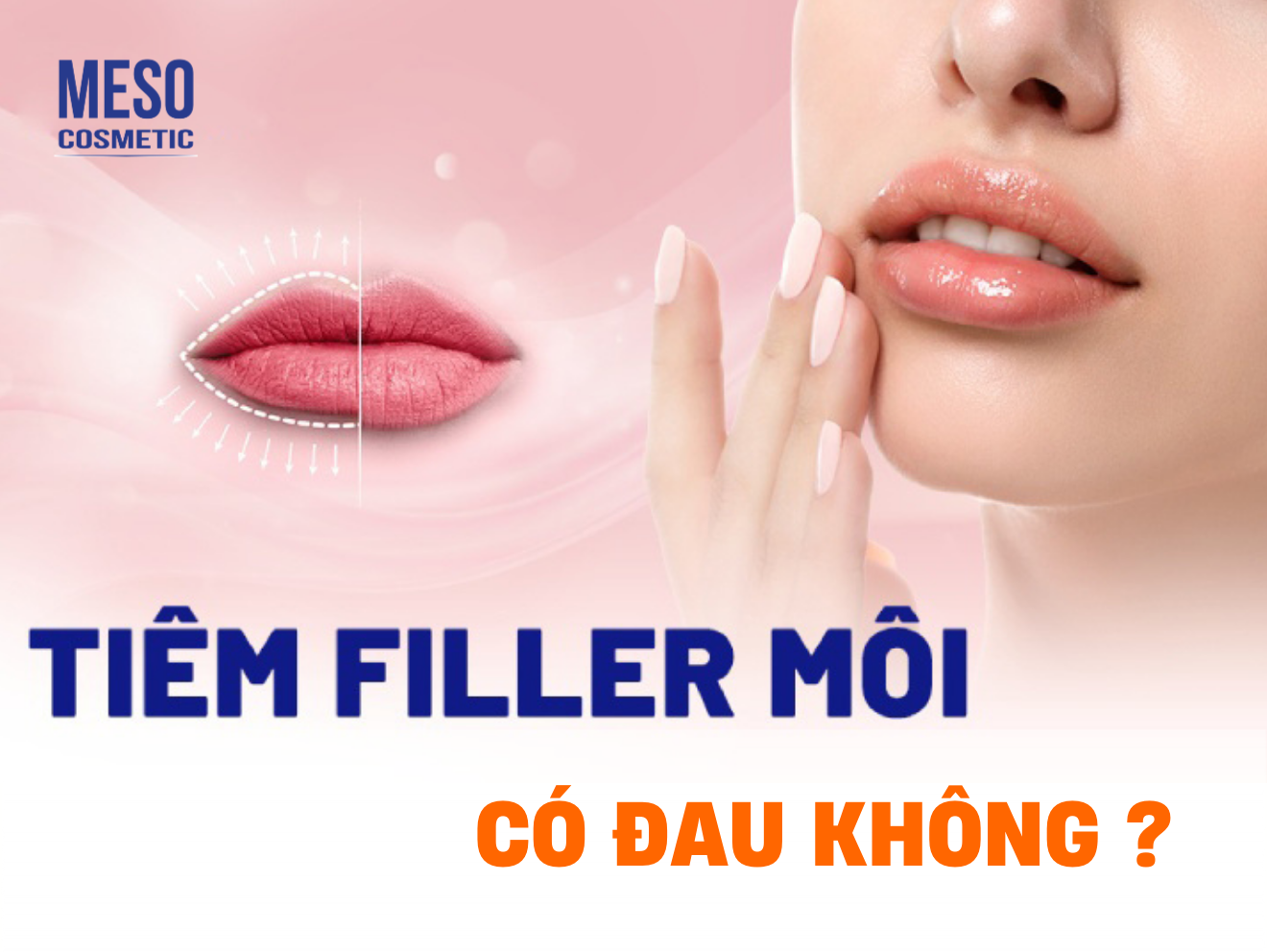 Tạo hình môi Baby, làm đầy môi