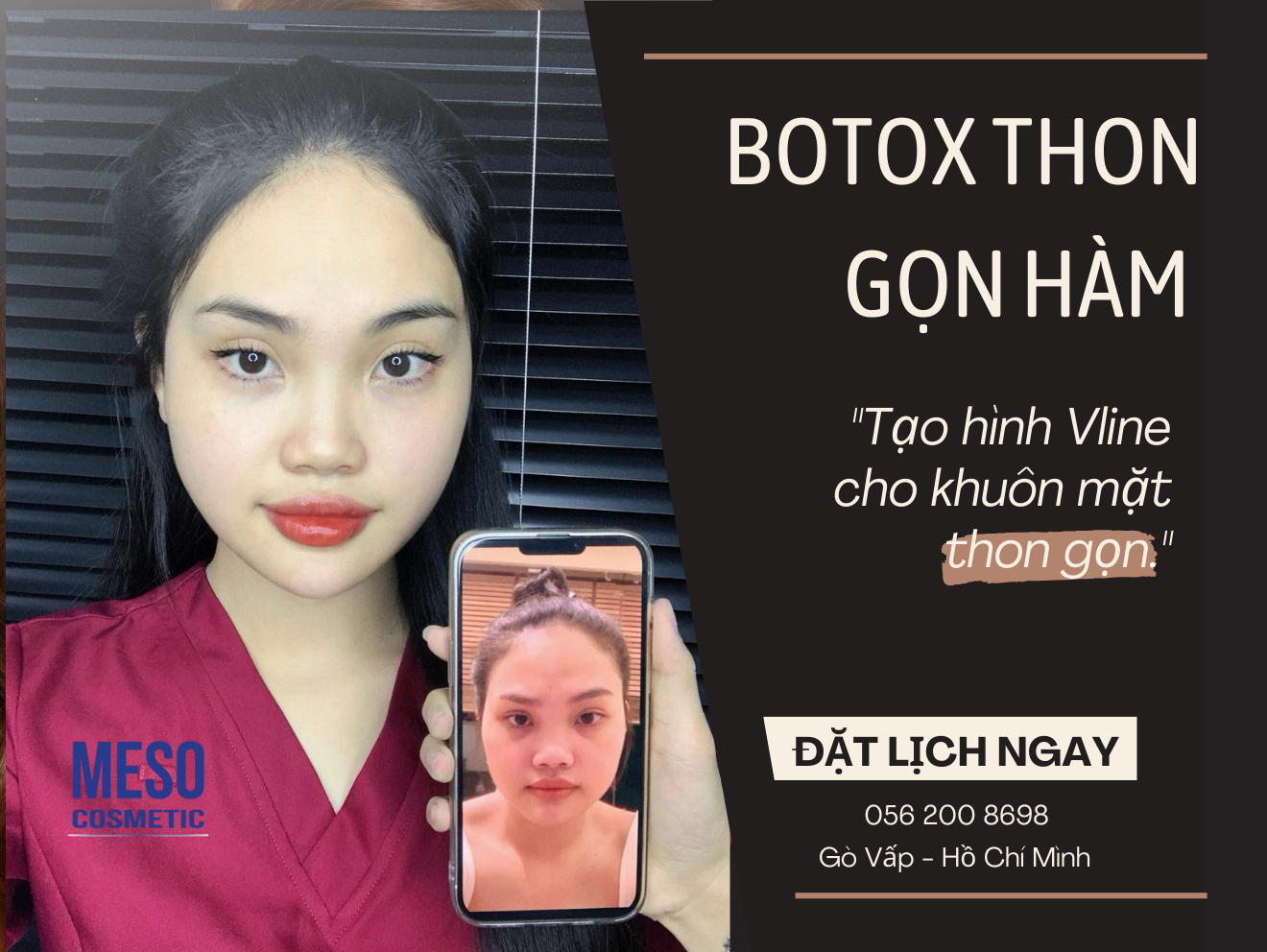 Thon gọn hàm, bắp tay, chân, nọng cằm