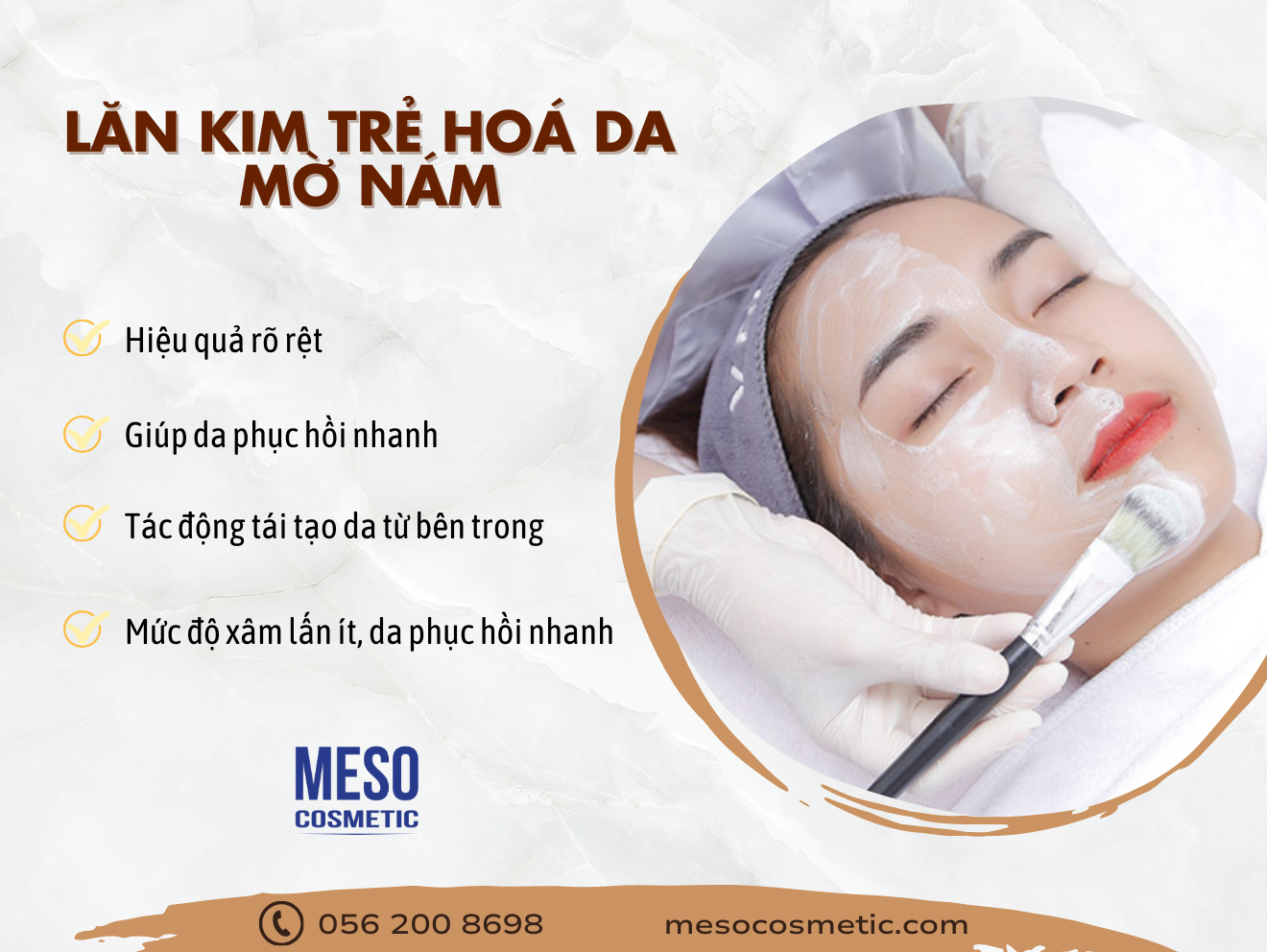 Lăn kim trẻ hoá, trị nám