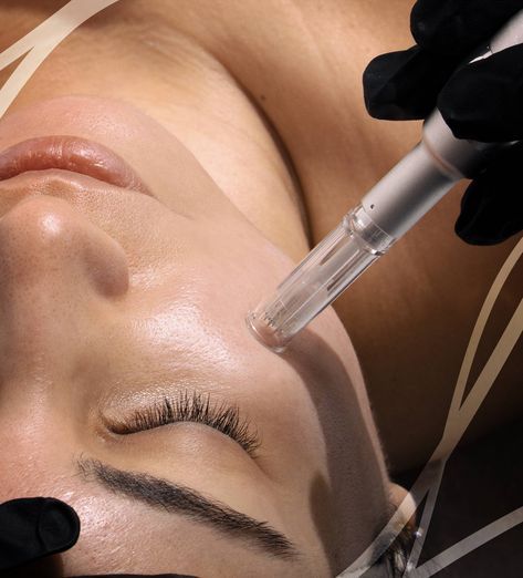 Nen-tiem-mesotherapy-bang-may-hay-bang-tay-se-hieu-qua-hon-_tiêm mesotherapy bằng máy.jpg