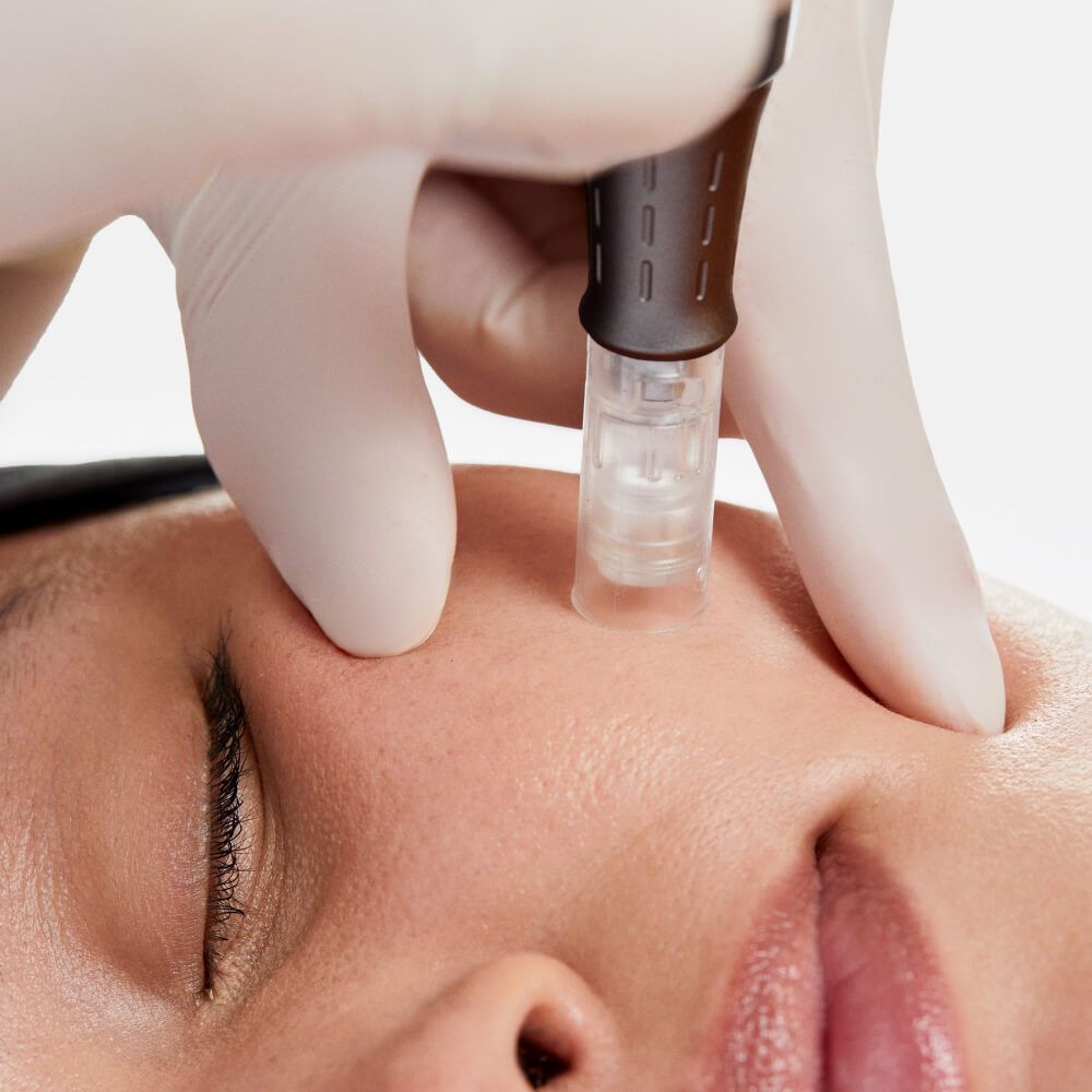 Nhung-Sai-Lam-Khi-Chon-Spa-Khien-Tien-Mat-Tat-Mang-3.jpg