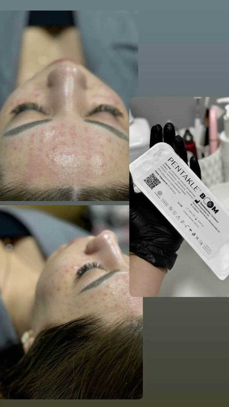 Nhung-Tieu-Chi-Chon-Spa-Clinic-Tiem-Meso-An-Toan_Những Tiêu Chí Chọn Spa Clinic Tiêm Meso An Toàn 1.jpg