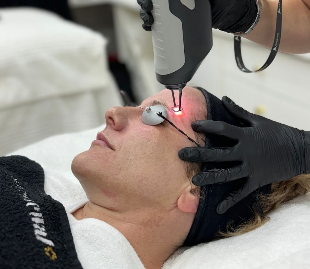 Sắc Tố Da Khó Cải Thiện? Đừng Bỏ Qua Laser Toning