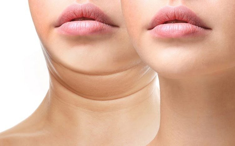 Thon-Gon-Ham-Bap-Tay-Chan-amp-Nong-Cam-Giai-Phap-Tham-My-An-Toan_Thon Gọn Hàm, Bắp Tay, Chân & Nọng Cằm – Giải Pháp Thẩm Mỹ An Toàn.jpg