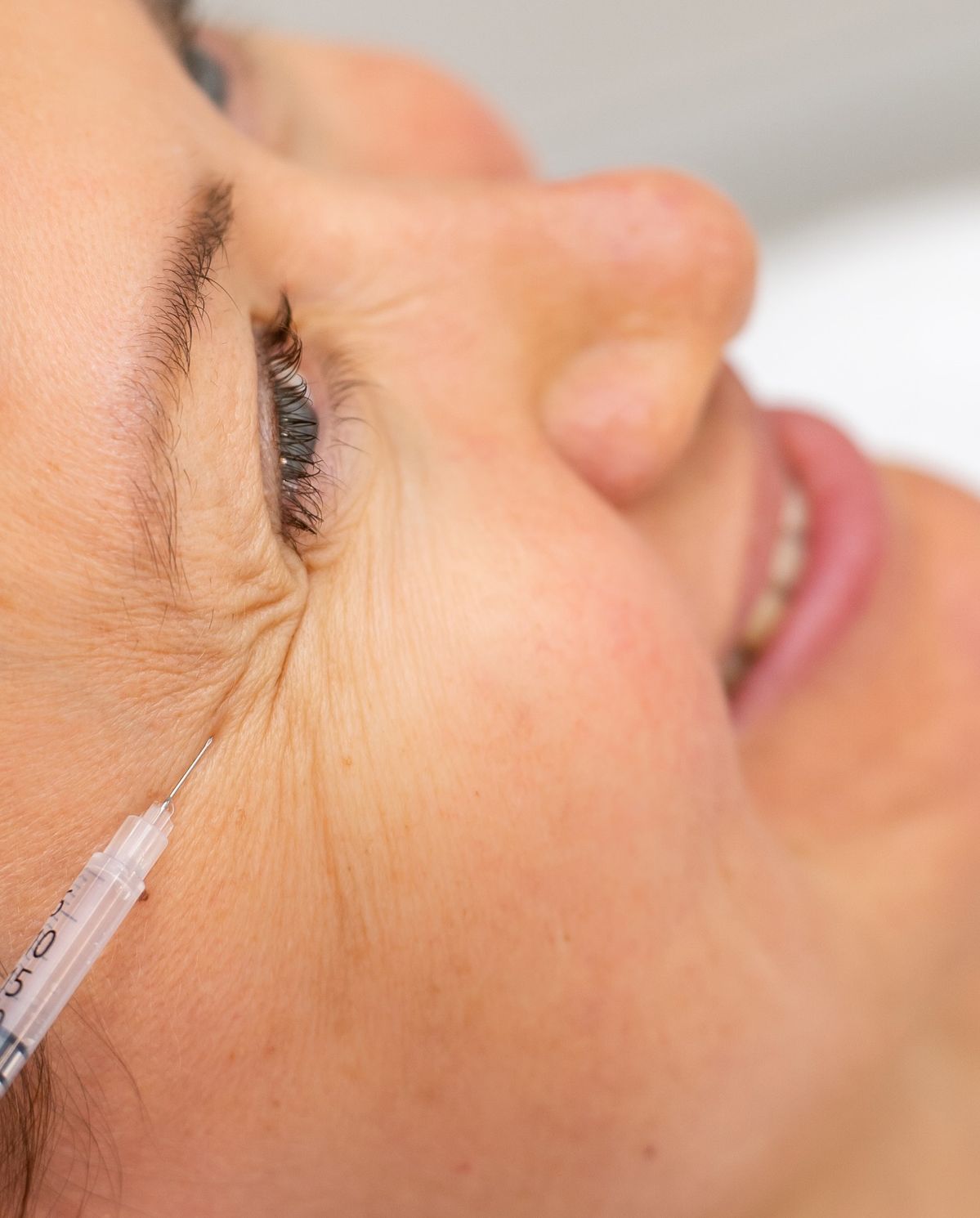 Cach-Giu-Hieu-Qua-Tiem-Botox-Xoa-Nhan-Lau-Hon-6-Bi-Quyet-1.jpg