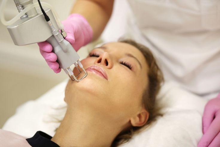 Laser-va-peel-tri-tham-cai-nao-hieu-qua-hon-.jpg