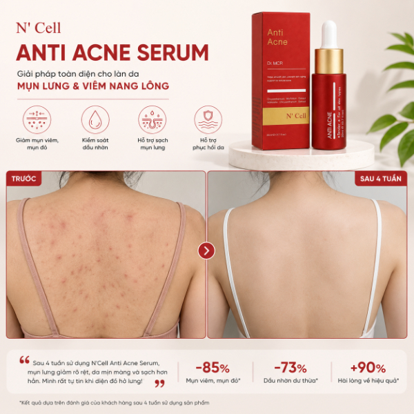 Serum N'Cell Anti Acne 20ml.jpg