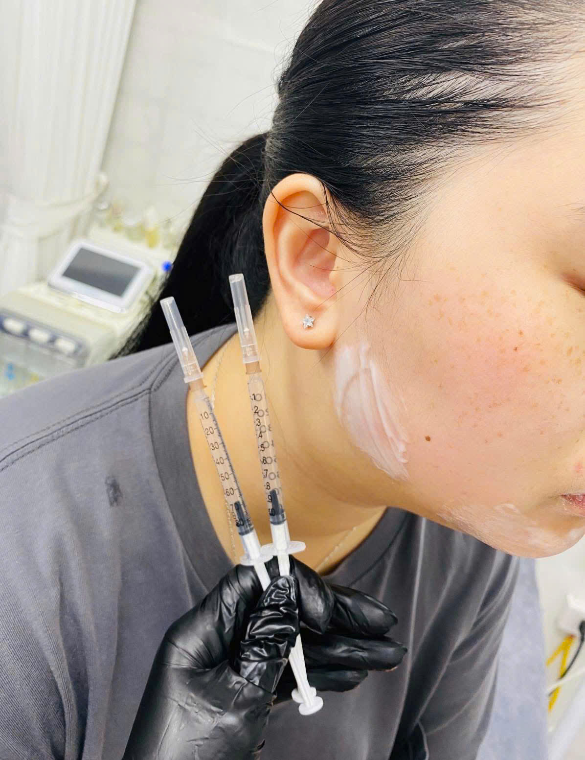 Tiem-Botox-Co-Lam-Mat-Bi-Cung-Khong--1.jpg