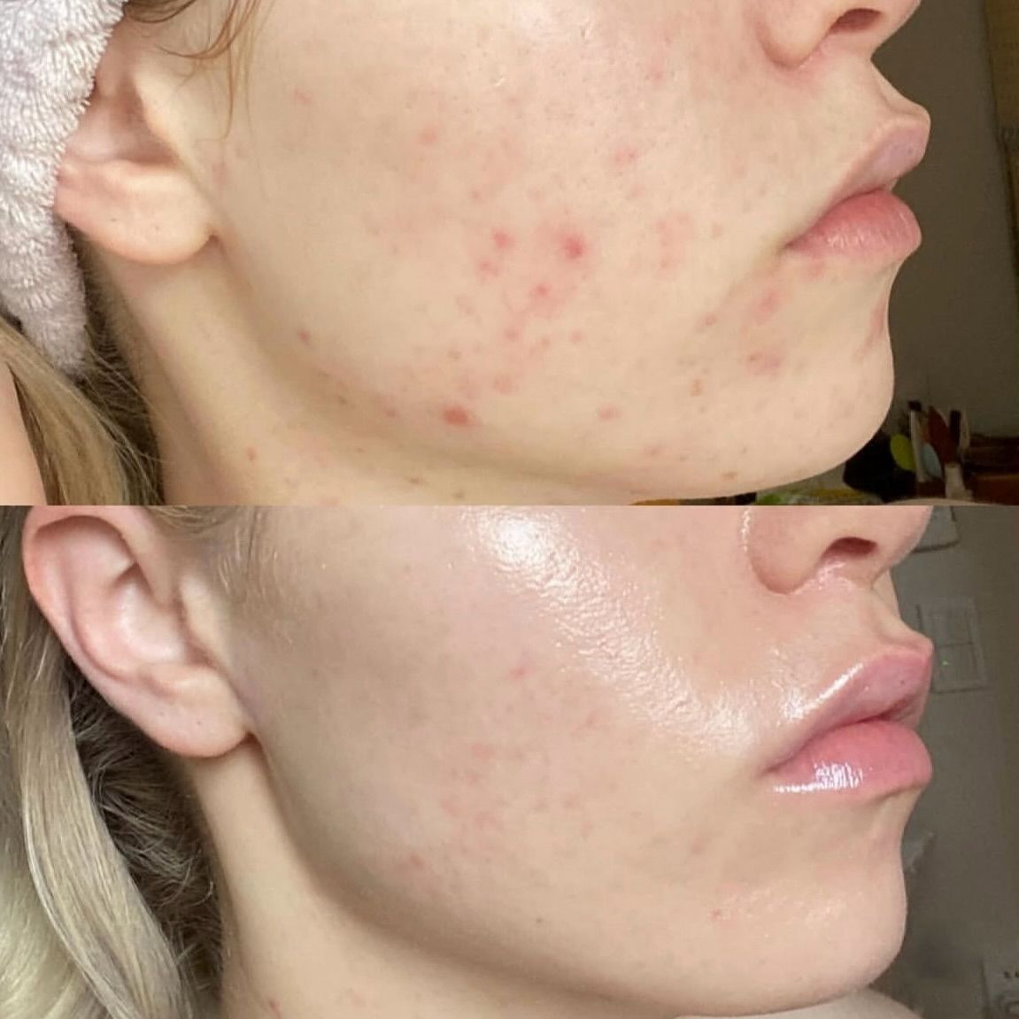 Tretinoin-bi-do-rat-7-cach-phuc-hoi-da-nhanh-1.jpg
