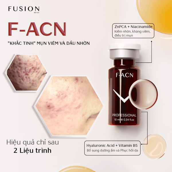 Tinh chất giảm và ngăn ngừa mụn Fusion F - ACN 10ml