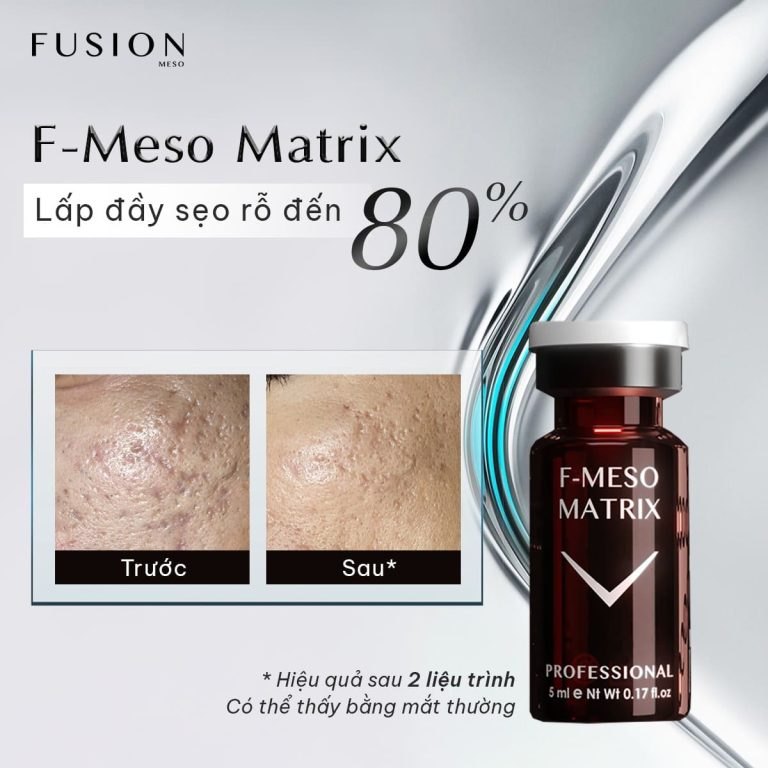 Tinh chất điều trị đầy sẹo lõm, sẹo rỗ Fusion F-Meso Matrix 5ml