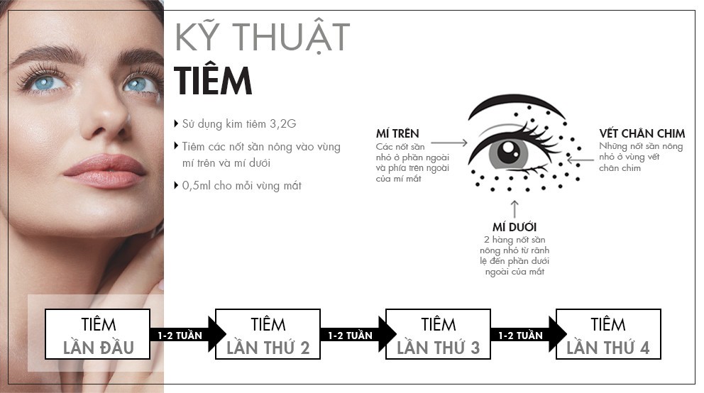 Tinh chất tiêm trẻ hóa và làm đầy vùng mắt Jalupro Young Eye hộp 1ml