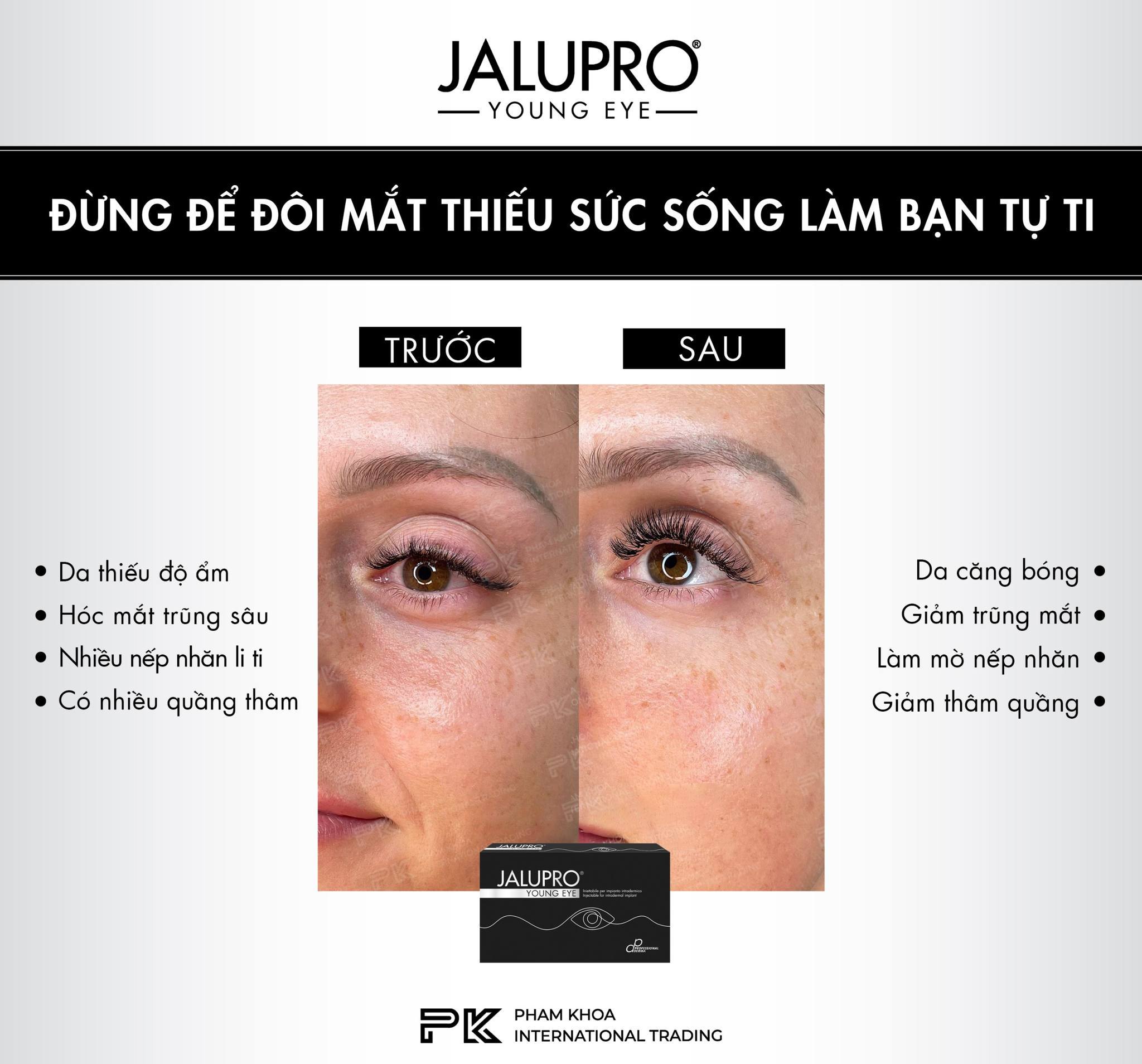 Tinh chất tiêm trẻ hóa và làm đầy vùng mắt Jalupro Young Eye hộp 1ml