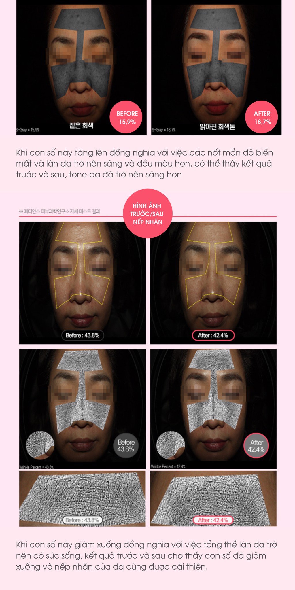 Ahohaw peptide hydrogel multi cream / kem dưỡng botox peptide, phục hồi & cải thiện nếp nhăn