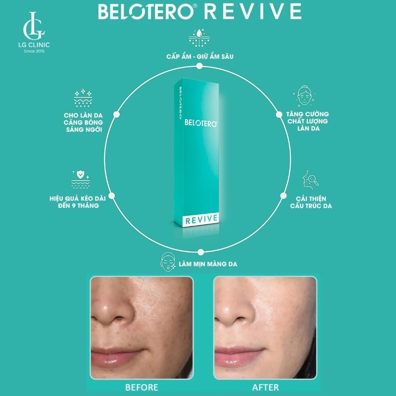 Belotero Revive cấp ẩm sâu, trẻ hoá, xoá nhăn