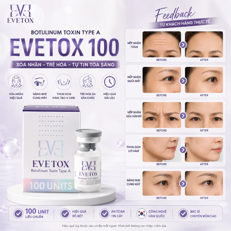 Botox EVETOX 100 – Giải Pháp Xóa Nhăn, Thon Gọn Gương Mặt Chuẩn Hàn Quốc