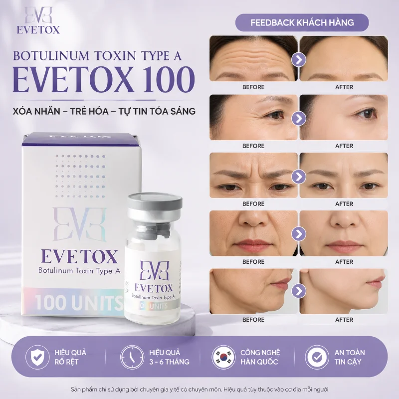 Botox EVETOX 100 – Giải Pháp Xóa Nhăn, Thon Gọn Gương Mặt Chuẩn Hàn Quốc