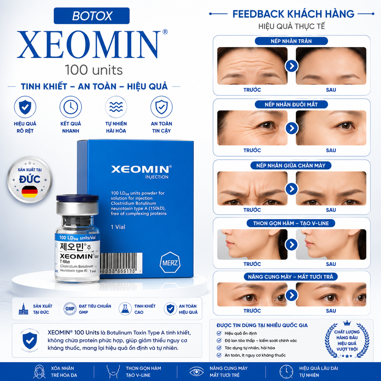Botox Xeomin 100 Đức Chính Hãng - Botulinum Toxin Type A Hỗ Trợ Xóa Nhăn, Nâng Cơ
