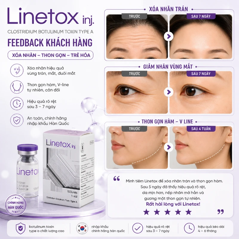 Botox xóa nhăn, trẻ hóa da và thon gọn hàm LINETOX 100 Units