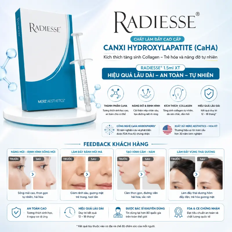Chất làm đầy RADIESSE® MERZ AESTHETICS Canxi Hydroxylapatite CaHA 1.5ml