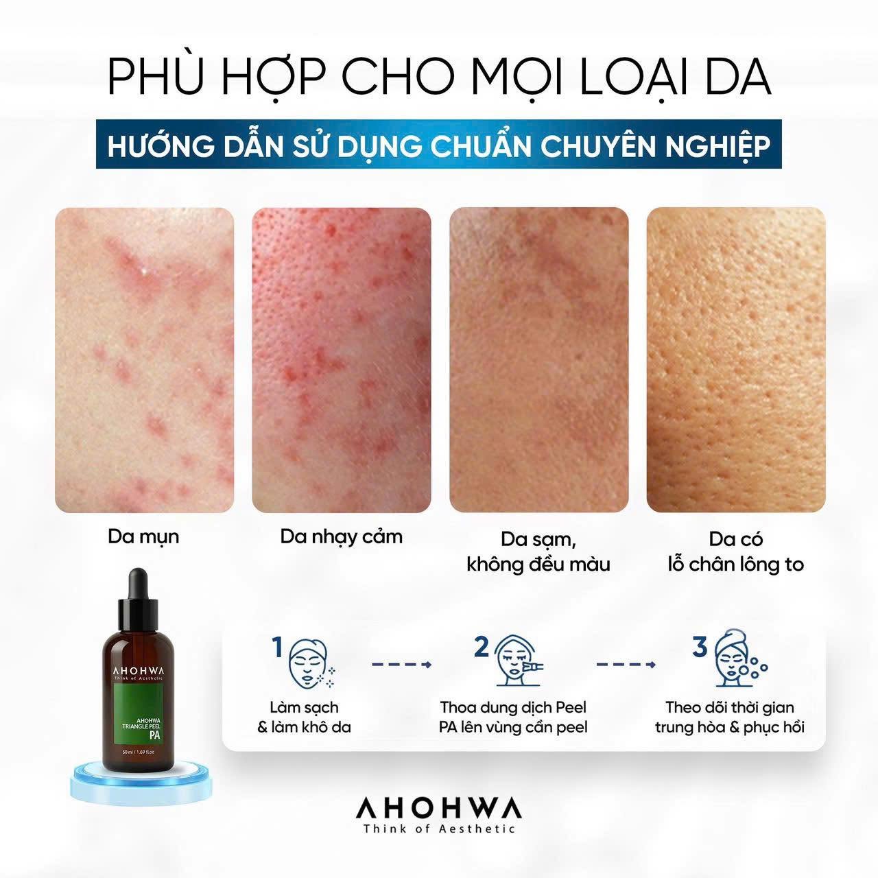 Dung dịch peel dành cho mọi loại da Ahohwa Triangle Peel Pa