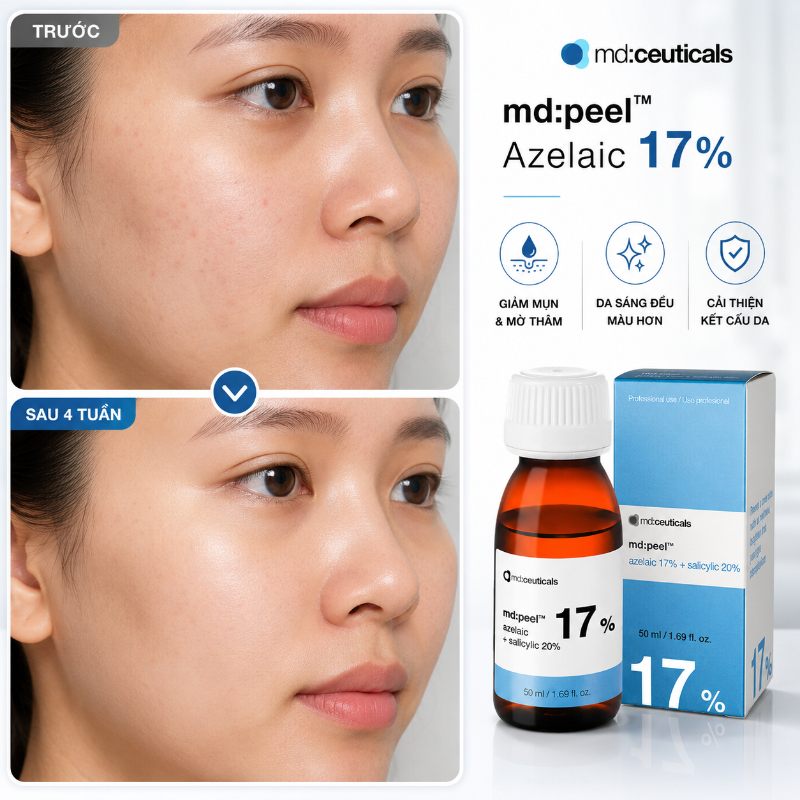 Dung dịch peel làm sáng da loại bỏ mụn cấp độ 1,2 Md:Ceuticals Md:Peel Azelaic 17%+Salicylic 20%