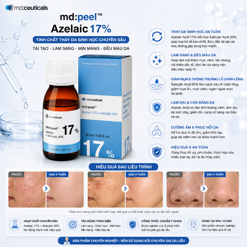 Dung dịch peel làm sáng da loại bỏ mụn cấp độ 1,2 Md:Ceuticals Md:Peel Azelaic 17%+Salicylic 20%