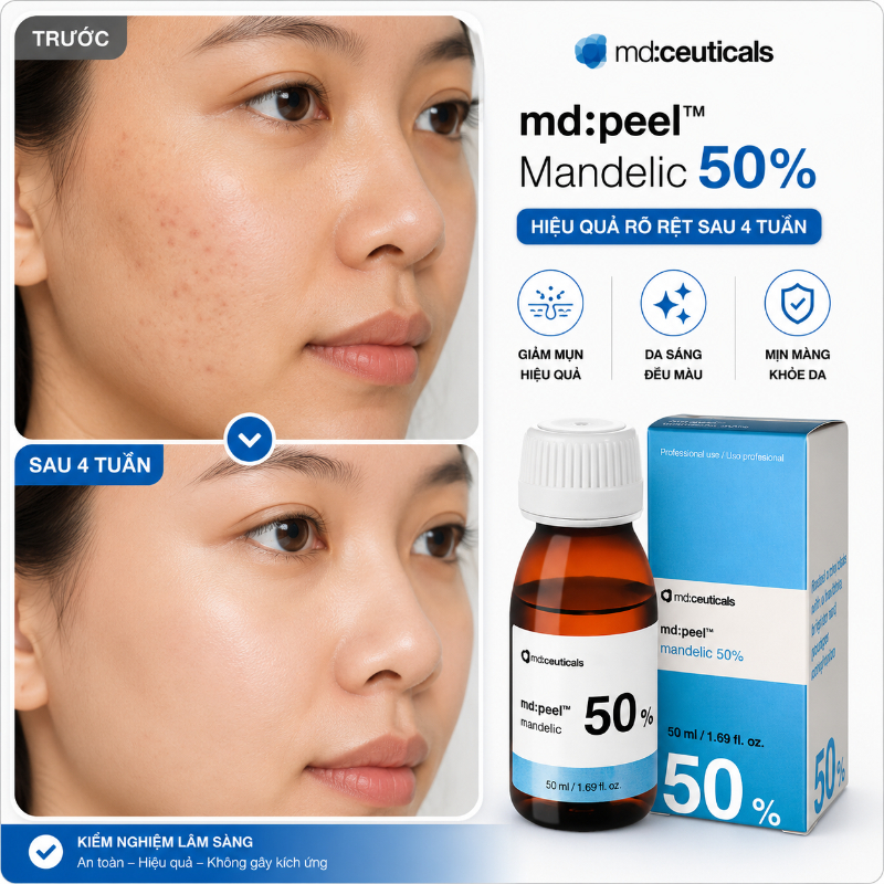 Dung dịch peel xóa nám sáng da ngăn ngừa lão hóa Md:Ceuticals Md:Peel Mandelic 50%