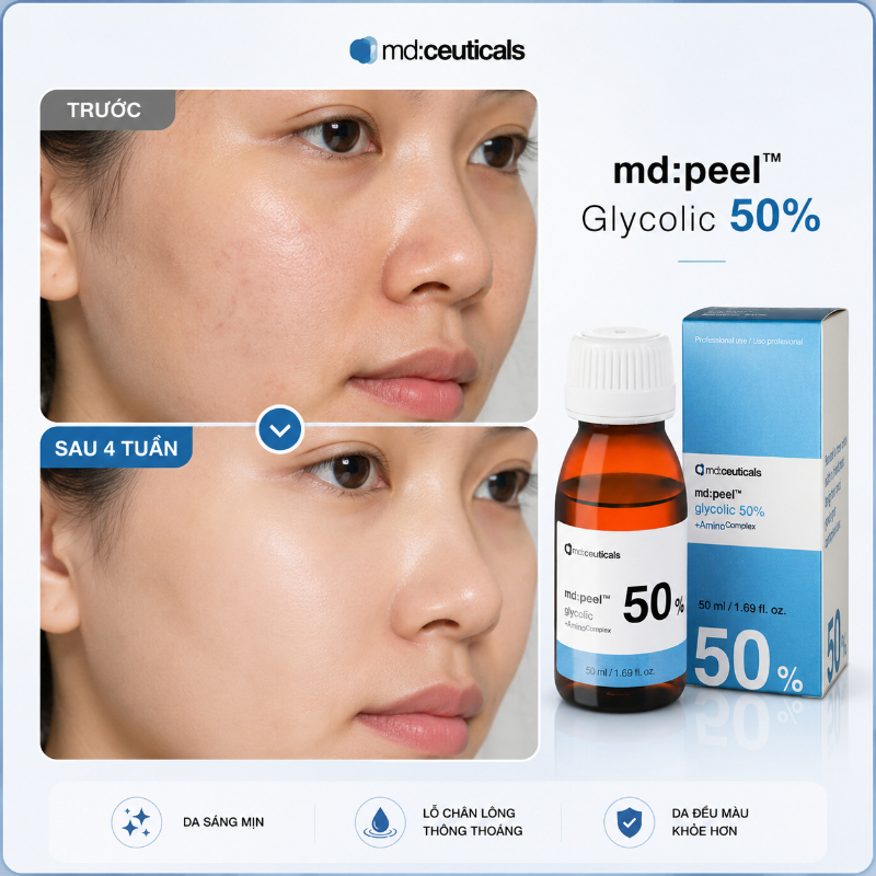 Dung dịch peel xóa nhăn trẻ hóa da Md:Ceuticals Md:Peel Glycolic 50%