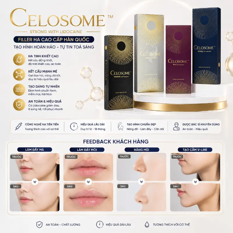 Chất Làm Đầy Celosome Hàn Quốc Tạo Hình Môi, Thái Dương, Hốc Mắt & Rãnh Sâu