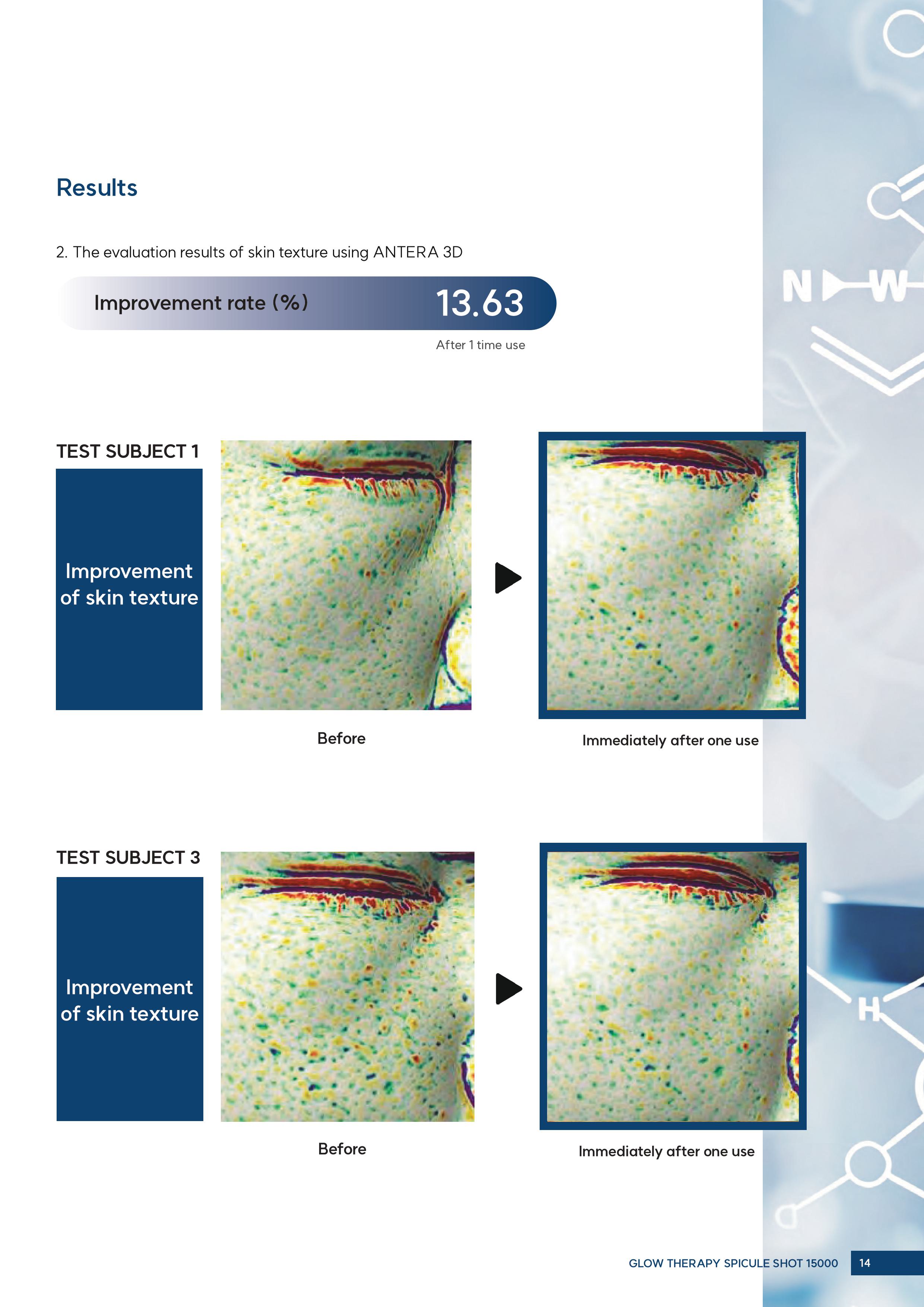 Tinh chất Tái Tạo Da Với Công Nghệ Vi Kim Sinh Học Glutanex Glow Therapy Spicule Shot 50000