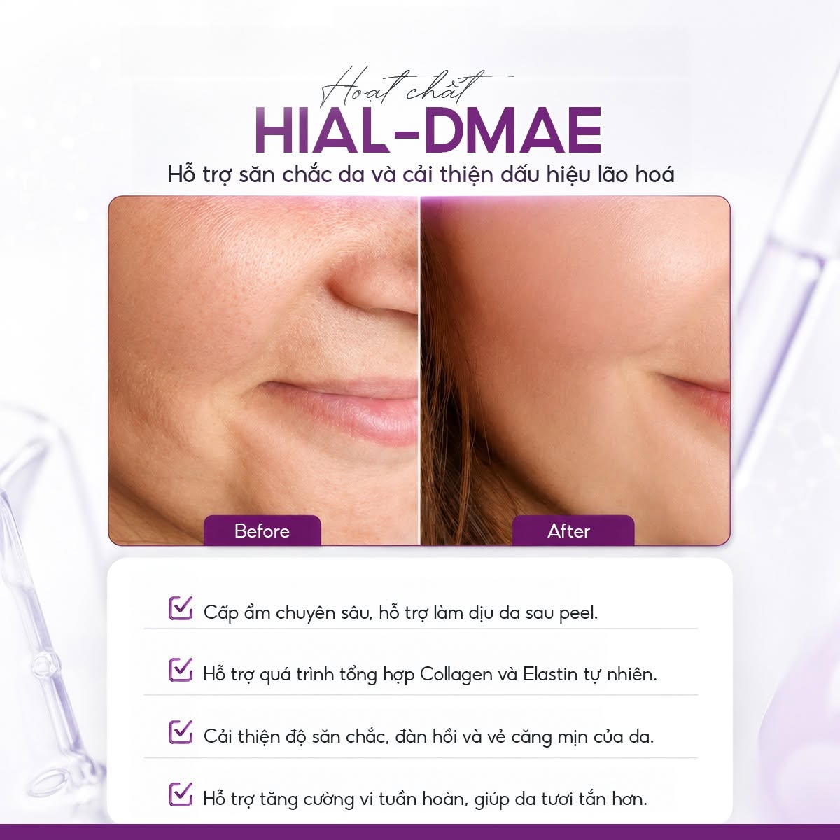 HIAL-DMAE MESO SKINCLINIC - TINH CHẤT SĂN CHẮC DA, GIẢM CHẢY XỆ