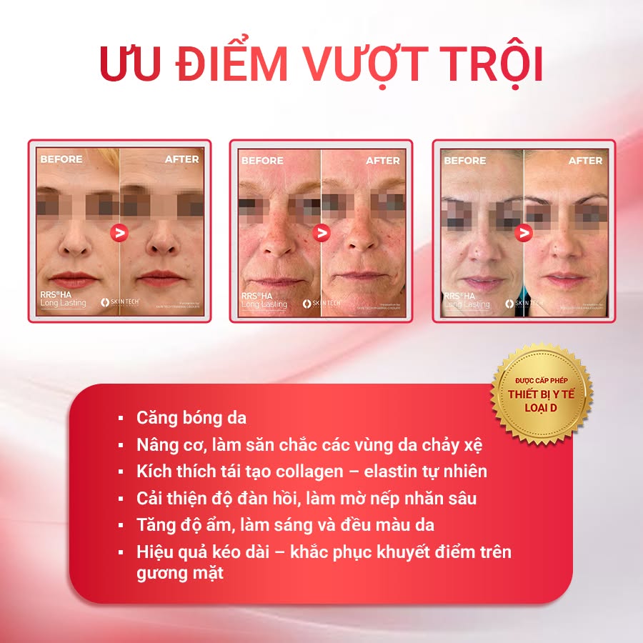 Hoạt chất B.A.P trẻ hóa da, nâng cơ SkinTech RRS® HA Long Lasting