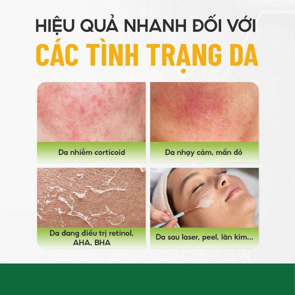 Huyết thanh phục hồi làm dịu da căng bóng da Skin Repair Innoaesthetics