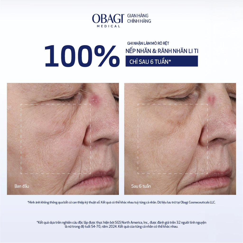 Kem Dưỡng Nâng Cơ, Săn Chắc Da Obagi ELASTIderm Lift Up & Sculpt 50ml