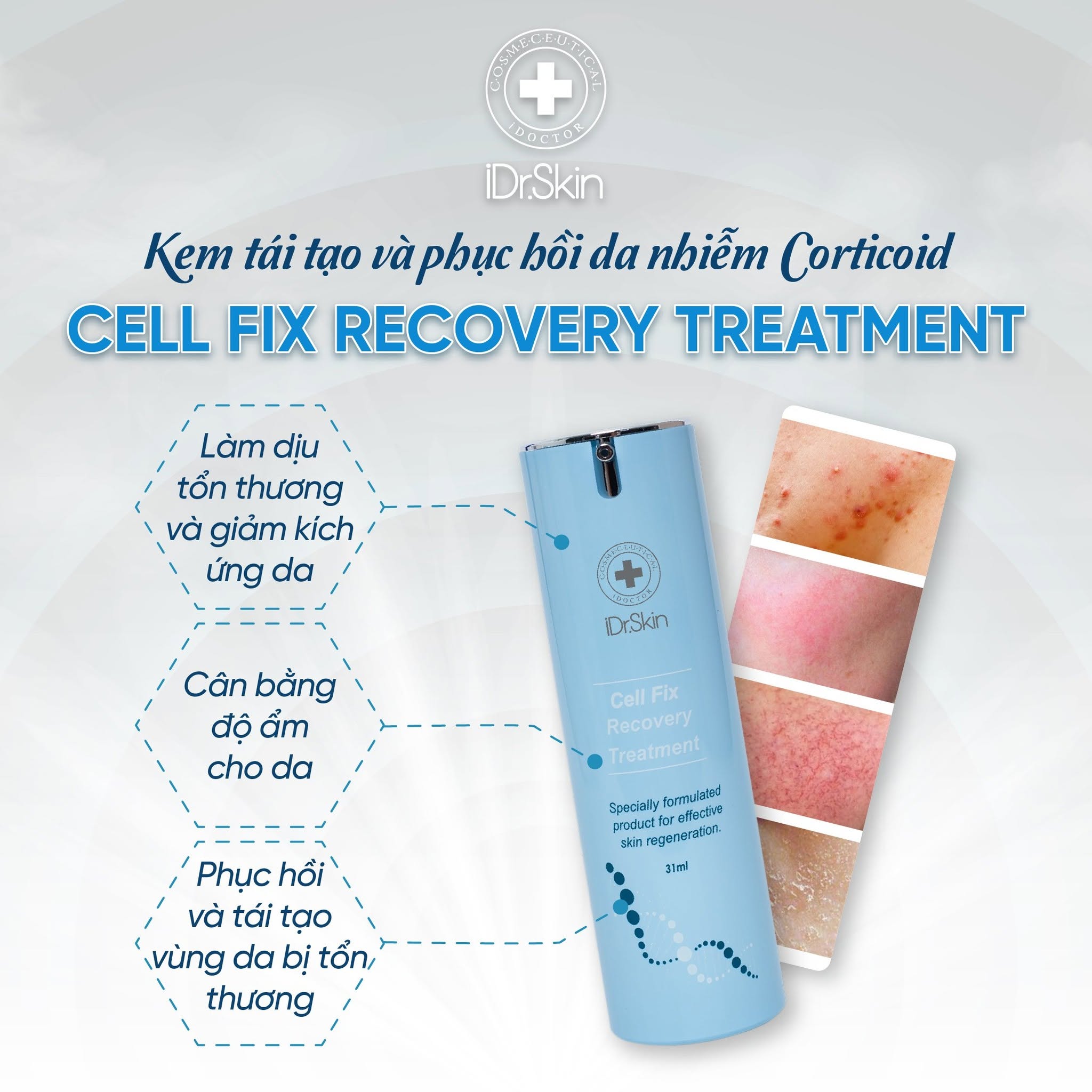 Kem Dưỡng Phục Hồi Da iDr.Skin Cell Fix Recovery Treatment 31ml