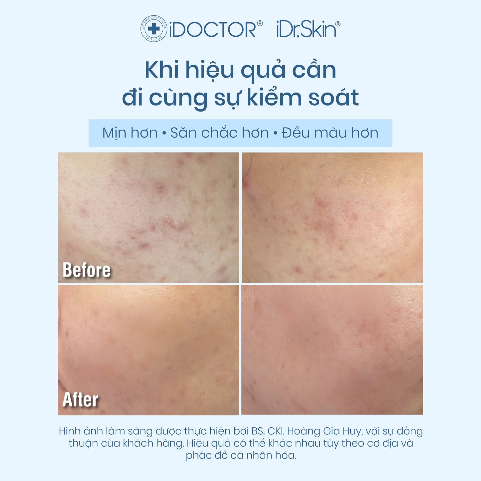 Kem Dưỡng Retinol 0.5% Cải Thiện Da Lão Hóa Retinol Recovery Treatment iDr.Skin 30ml