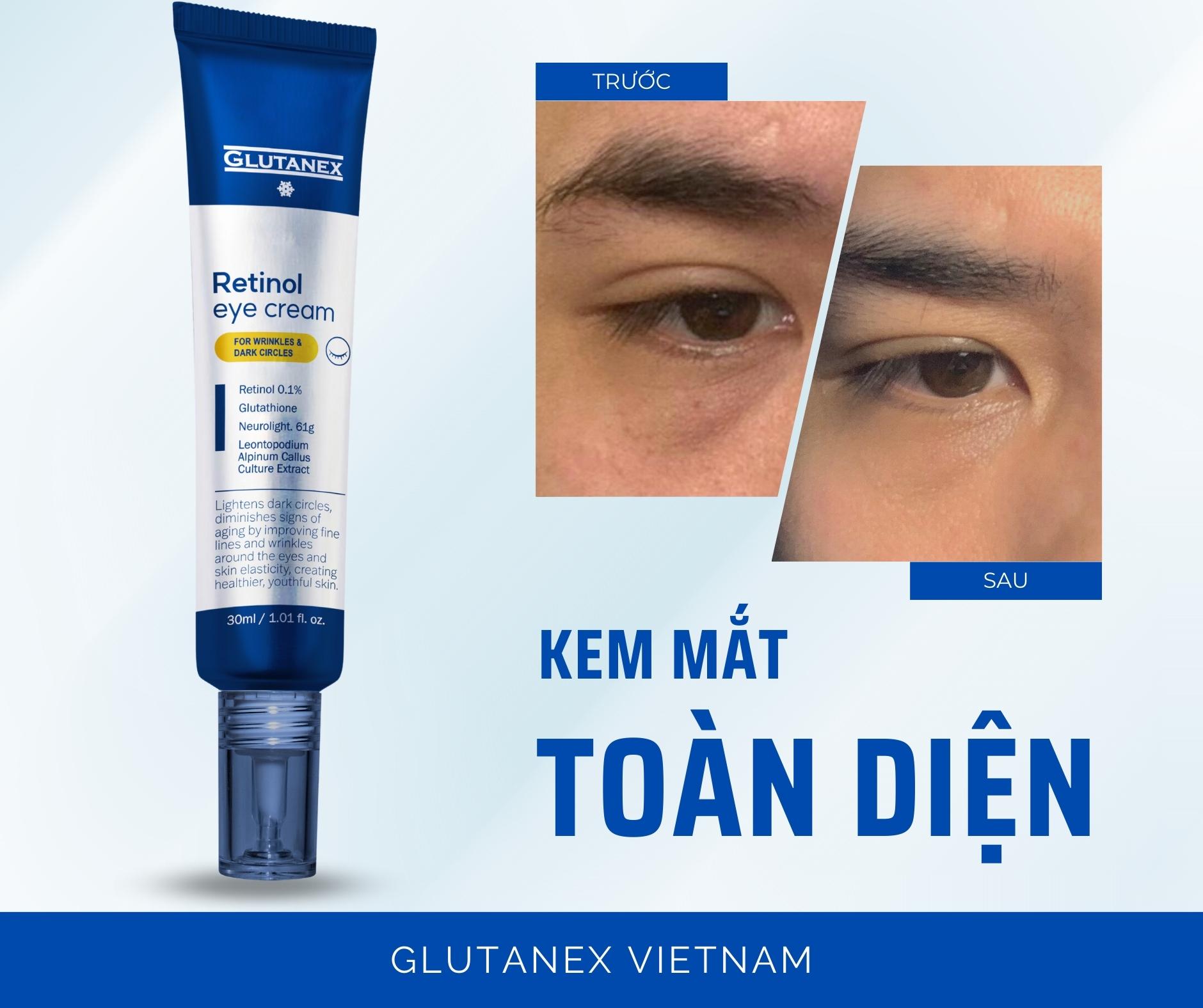 Kem Mắt Hỗ Trợ Cải Thiện Thâm, Giảm Nếp Nhăn & Trẻ Hóa Vùng Mắt Glutanex Glow Therapy Eye Cream 30ml Chính Hãng
