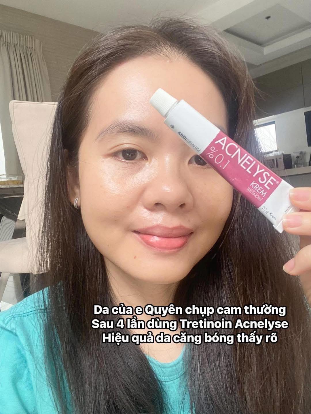 Kem Tretinoin Acnelyse 0.025% 0.05% 0.1% krem Thổ 20g