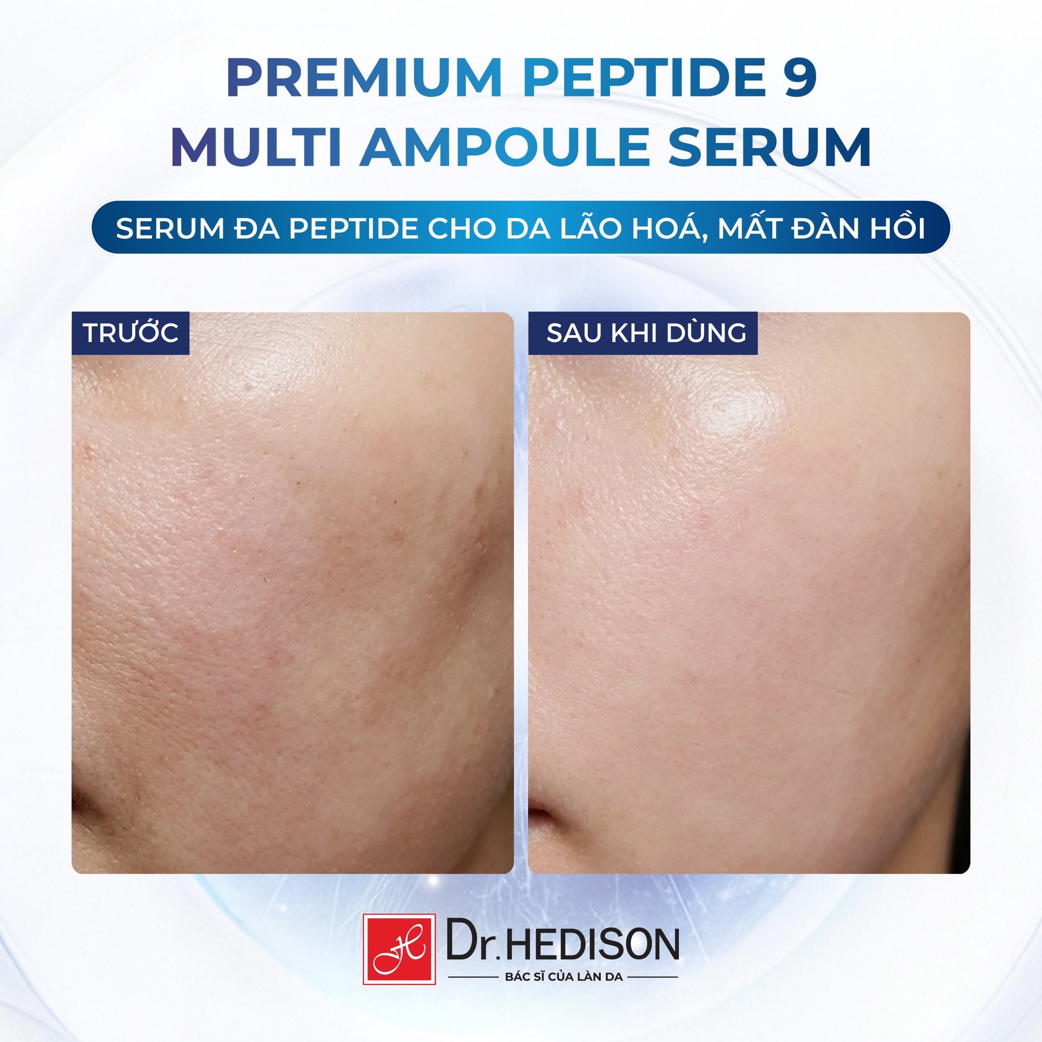 Kem dưỡng giảm nếp nhăn, tăng độ đàn hồi Dr.HEDISON Premium Peptide 9+ Multi Cream