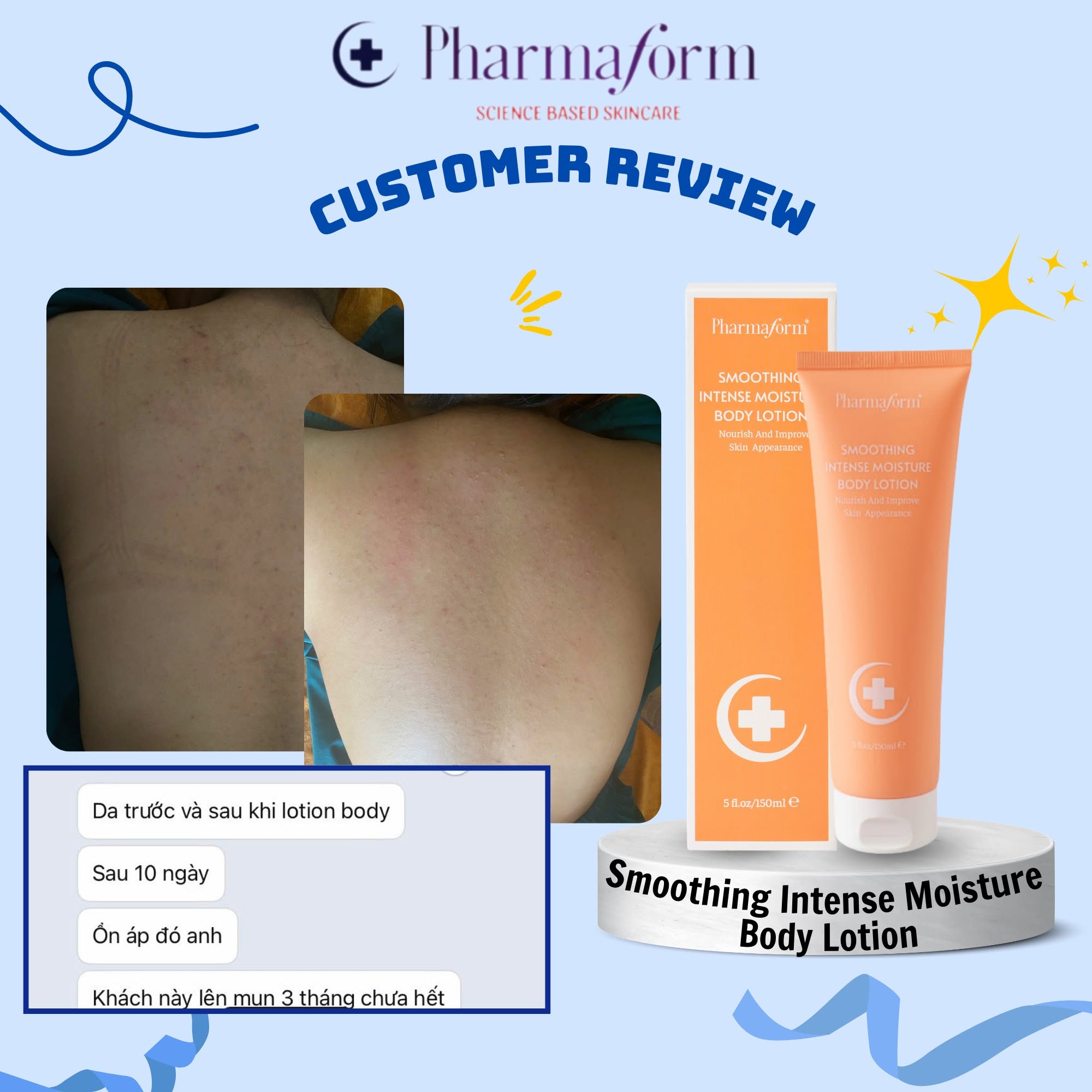 Kem loại bỏ tế bào chết duy trì làn da mềm mại Pharmaform Smoothing Intense Moisture Body Lotion