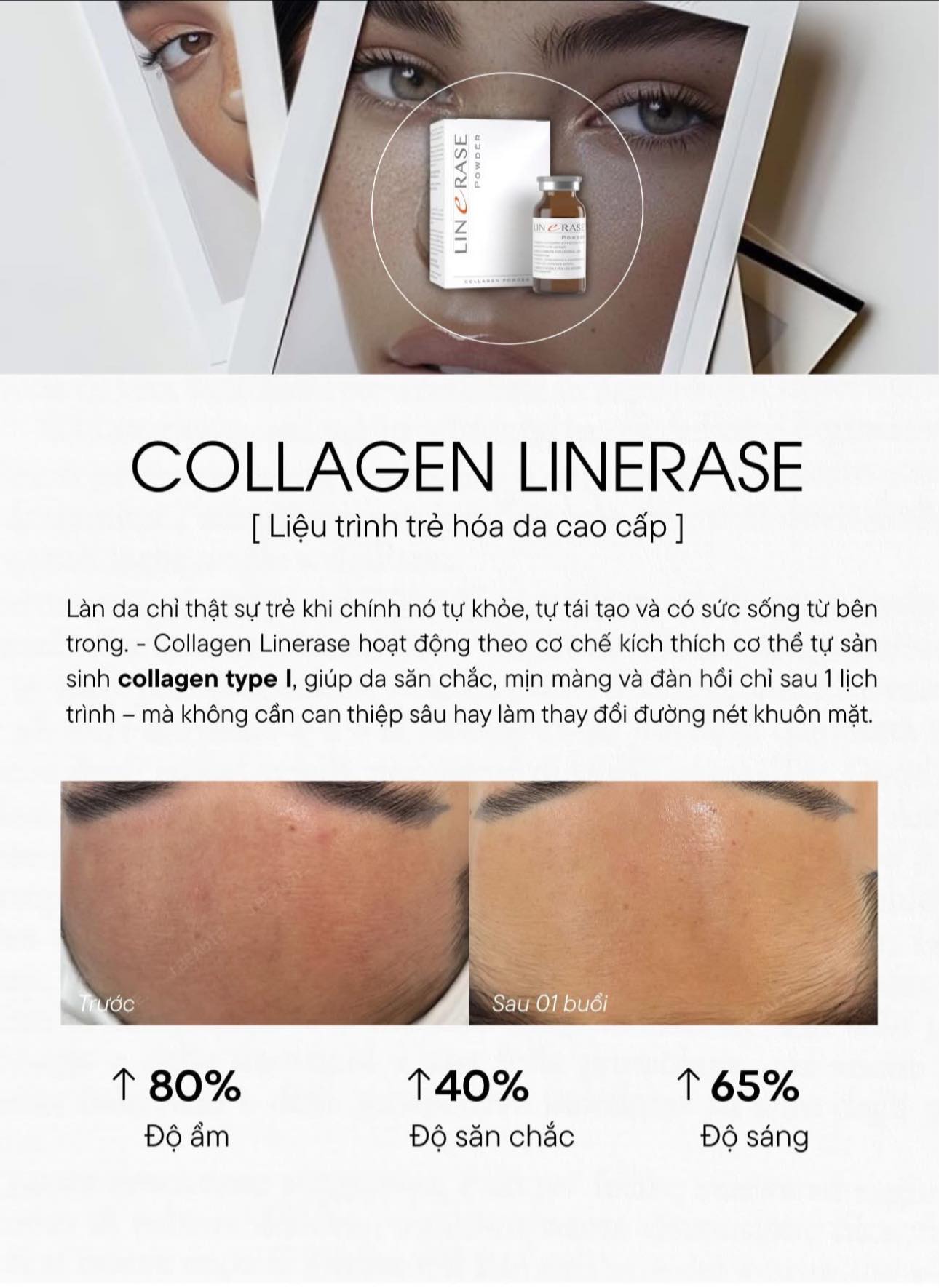 LINERASE COLLAGEN – PHỤC HỒI & TÁI TẠO DA THẾ HỆ MỚI BẰNG COLLAGEN SINH HỌC