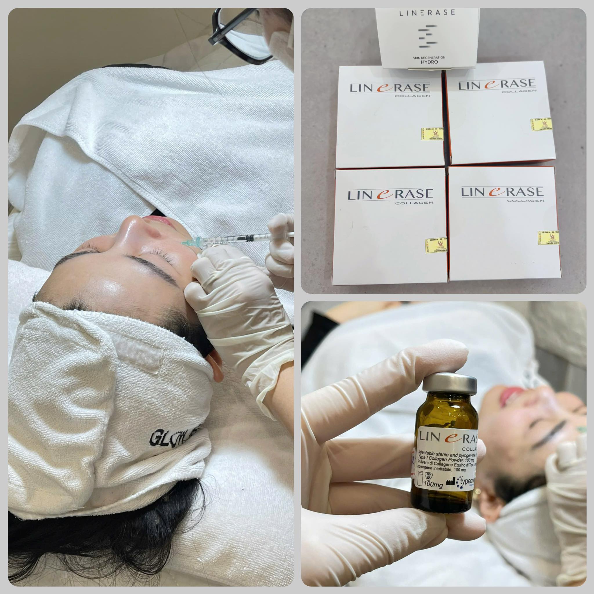 LINERASE COLLAGEN – PHỤC HỒI & TÁI TẠO DA THẾ HỆ MỚI BẰNG COLLAGEN SINH HỌC