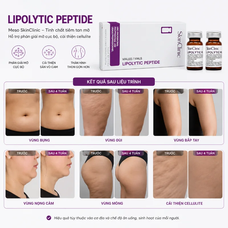 LIPOLYTIC PEPTIDE MESO SKINCLINIC - TINH CHẤT ĐÀO THẢI MỠ CHO VÙNG BODY 1 LỌ